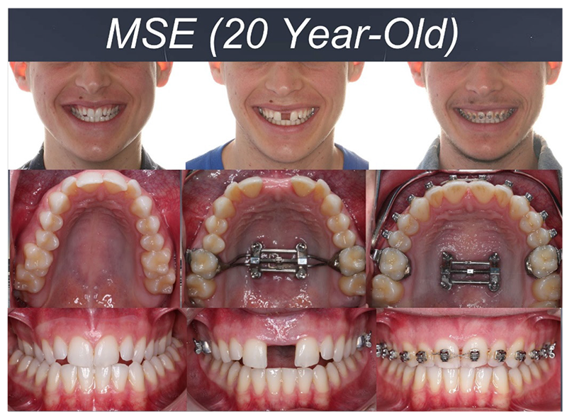 MSE collage of a patient's treatment