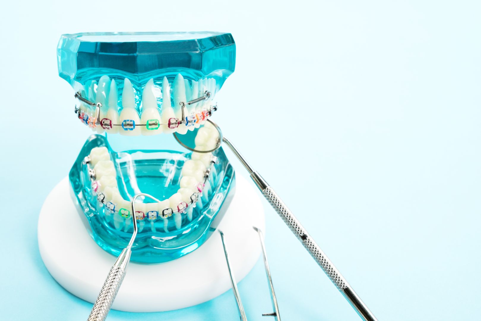 What to Know Before Getting Braces